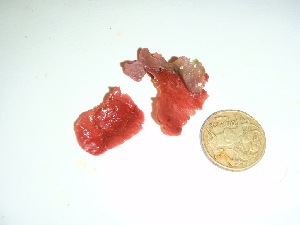  ( - GWS037392)  @11 [ ] Unspecified (default): All Rights Reserved  Unspecified Unspecified