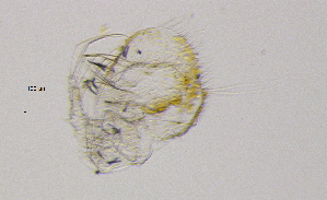  (Ilyocryptus cf. sordidus - BarCrust 158)  @11 [ ] CreativeCommons - Attribution Non-Commercial Share-Alike (2015) A. Hobæk Norwegian Institute for Water Research