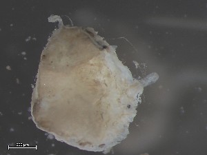  ( - HMSC174_01810)  @11 [ ] CreativeCommons - Attribution Share-Alike (2025) Unspecified Huntsman Marine Science Centre