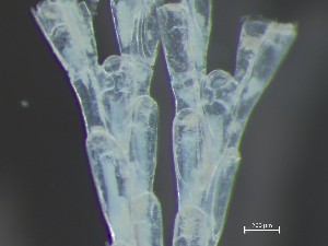  (Bugulopsis - HMSC174_04139)  @11 [ ] CreativeCommons - Attribution Share-Alike (2025) Unspecified Huntsman Marine Science Centre