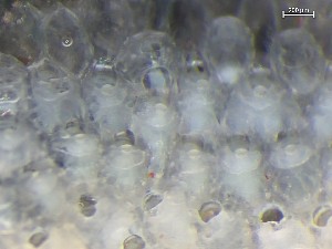  ( - HMSC174_01398)  @11 [ ] CreativeCommons - Attribution Share-Alike (2025) Unspecified Huntsman Marine Science Centre