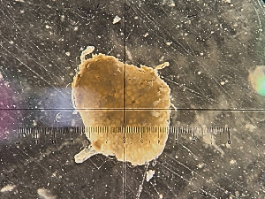  ( - HMSC174_01810)  @11 [ ] CreativeCommons - Attribution Share-Alike (2025) Unspecified Huntsman Marine Science Centre