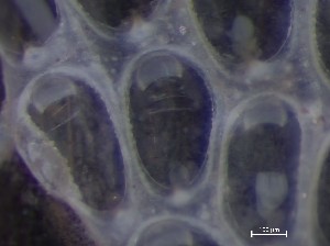  ( - HMSC174_03981)  @11 [ ] CreativeCommons - Attribution Share-Alike (2025) Unspecified Huntsman Marine Science Centre