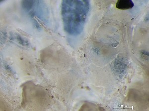  (Rhamphostomella cristata - HMSC174_04298)  @11 [ ] CreativeCommons - Attribution Share-Alike (2025) Unspecified Huntsman Marine Science Centre