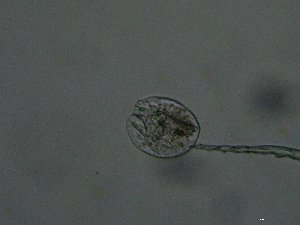  (Testudinella truncata - BGE_00073_A06)  @11 [ ] CreativeCommons  Attribution by Evangelia Michaloudi (2023) Evangelia Michaloudi Aristotle University of Thessaloniki