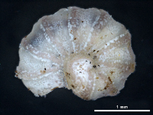  (Trachysphaera racovitzai - BGE_00515_C03)  @11 [ ] Copyright (c) (2025) Unspecified University of Belgrade - Faculty of Biology
