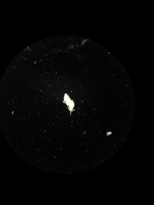  (Oncopodura sp. Rad - BGE_00522_G07)  @11 [ ] Attribution Non-Commercial Share-Alike (by-nc-sa) (2013) Marko Lukic Croatian Biospeleological Society, Zagreb