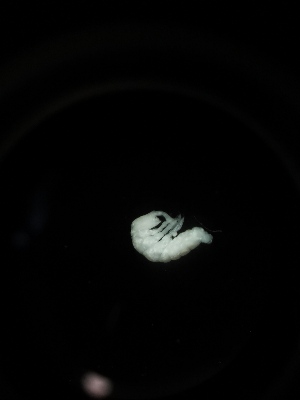  (Onychiuroides sp. Vel - BGE_00524_B11)  @11 [ ] Attribution Non-Commercial Share-Alike (by-nc-sa) (2013) Marko Lukic Croatian Biospeleological Society, Zagreb