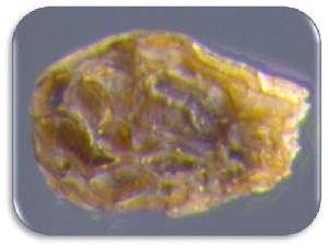  (Phelipanche aegyptiaca - 30152-40)  @11 [ ] No Rights Reserved (2017) Radi Aly Agricultural Research Organization, Israel