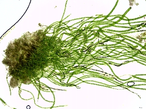  (Ulotrichaceae - JLC00078)  @11 [ ] by-nc (2022) Unspecified Canadian Museum of Nature