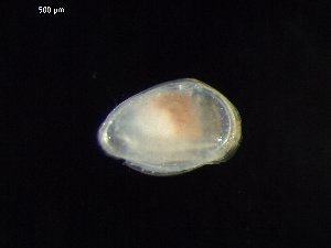  (Trachyleberididae - DSB_2739)  @11 [ ] Copyright (2015) Inga Mohrbeck German Center for Marine Biodiversity Research, Senckenberg