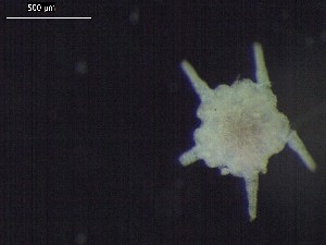  (Amphioplus cf. daleus - DSB_3511)  @11 [ ] Copyright (2019) Magdalini Christodoulou German Center for Marine Biodiversity Research