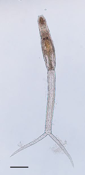  (Trichobilharzia physellae - Pha1-21-002)  @11 [ ] CC BY-NC-SA (2021) Elisabeth Haring Natural History Museum Vienna