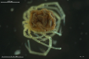  (Lebertia contracta - HYDCA862)  @11 [ ] Creative Commons  Attribution Non-Commercial Share-Alike (2023) NTNU University Museum, Department of Natural History NTNU University Museum, Department of Natural History
