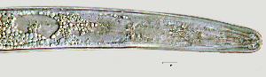  ( - NID-N1033)  @11 [ ] CreativeCommons - Attribution Non-Commercial (2017) Tom Powers University of Nebraska