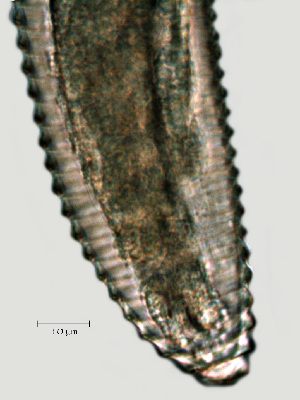  ( - NID-N1138)  @11 [ ] CreativeCommons - Attribution Non-Commercial (2017) Tom Powers University of Nebraska