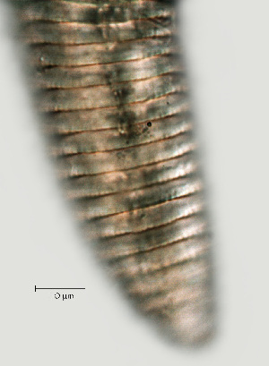  ( - NID-N1138)  @11 [ ] CreativeCommons - Attribution Non-Commercial (2017) Tom Powers University of Nebraska