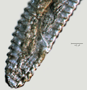  ( - NID-N1172)  @11 [ ] CreativeCommons - Attribution Non-Commercial (2017) Tom Powers University of Nebraska