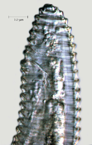 ( - NID-N1258)  @11 [ ] CreativeCommons - Attribution Non-Commercial (2017) Tom Powers University of Nebraska