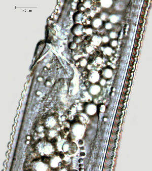  ( - NID-N1261)  @11 [ ] CreativeCommons - Attribution Non-Commercial (2017) Tom Powers University of Nebraska