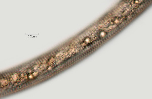  (Hemicycliophora thornei Singleton X - NID-N1292)  @11 [ ] CreativeCommons - Attribution Non-Commercial (2017) Tom Powers University of Nebraska