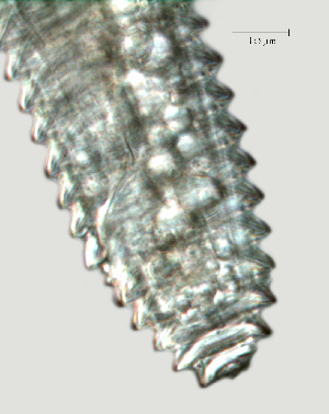  ( - NID-N2262)  @11 [ ] CreativeCommons - Attribution Non-Commercial (2017) Tom Powers University of Nebraska