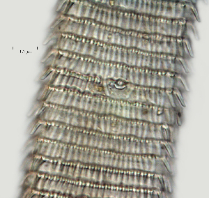  ( - NID-N2762)  @11 [ ] CreativeCommons - Attribution Non-Commercial (2017) Tom Powers University of Nebraska
