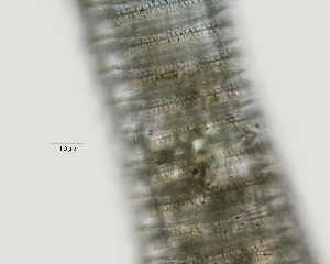 ( - NID-N3057)  @11 [ ] CreativeCommons - Attribution Non-Commercial (2016) Tom Powers University of Nebraska