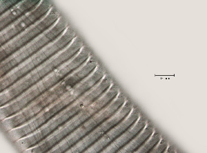  ( - NID-N431)  @11 [ ] CreativeCommons - Attribution Non-Commercial (2016) Tom Powers University of Nebraska