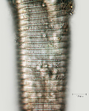  ( - NID-N733)  @11 [ ] CreativeCommons - Attribution Non-Commercial (2017) Tom Powers University of Nebraska