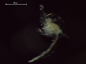  ( - CZ000063_crustaceans_Euphausia_diomedeae_100)  @11 [ ] Copyright (2020) Nancy F. Mercado-Salas Senckenberg am Meer