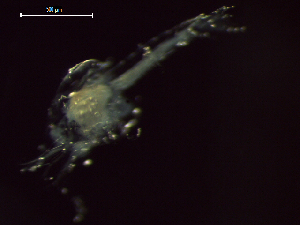  ( - CZ000064_crustaceans_Euphausia_diomedeae_100)  @11 [ ] Copyright (2020) Nancy F. Mercado-Salas Senckenberg am Meer