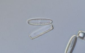  (Pinnularia subcommutata - UH1-6G)  @11 [ ] Unspecified (default): All Rights Reserved  Unspecified Unspecified