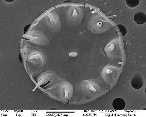  (Bacteriastrum - IK_MTA56_ITS)  @11 [ ] CreativeCommons - Attribution Non-Commercial Share-Alike (2015) Jim Ehrman Mount Allison University