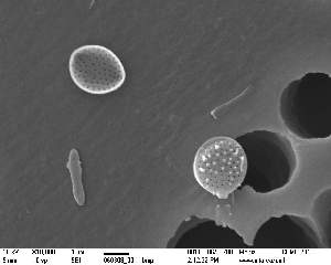  (Extubocellulus sp - IK_MTA400)  @11 [ ] CreativeCommons - Attribution Non-Commercial Share-Alike (2015) Jim Ehrman Mount Allison University