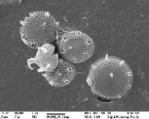  (Skeletonema grethae - IK_MTA358)  @11 [ ] CreativeCommons - Attribution Non-Commercial Share-Alike (2015) Jim Ehrman Mount Allison University