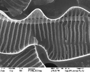  (Pseudonitzschia australis - IK_MTA321_ITS)  @11 [ ] CreativeCommons - Attribution Non-Commercial Share-Alike (2015) Jim Ehrman Mount Allison University