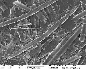  (Pseudonitzschia multiseries - IK_MTA327_ITS)  @11 [ ] CreativeCommons - Attribution Non-Commercial Share-Alike (2015) Jim Ehrman Mount Allison University