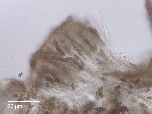  (Chaenothecopsis parasitaster - MCM466_ABMI09)  @11 [ ] CreativeCommons  Attribution Non-Commercial Share-Alike (2025) Diane L. Haughland Unspecified