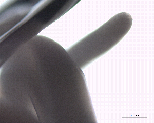  (Anisakis sp. 1 EB - DPDP-0405)  @11 [ ] No Rights Reserved (2016) Unspecified Unspecified
