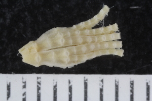 (Bathycrinidae - ZMBN_120570)  @11 [ ] CreativeCommons - Attribution Non-Commercial Share-Alike (2018) University of Bergen Natural History Collections