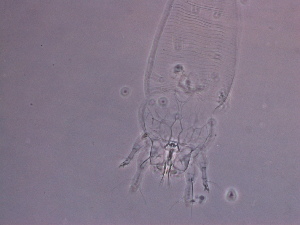  (Diptilomiopus sp. S142 - S142-1)  @11 [ ] CreativeCommons - Attribution Non-Commercial Share-Alike (2020) Unspecified Nanjing Agriculture university