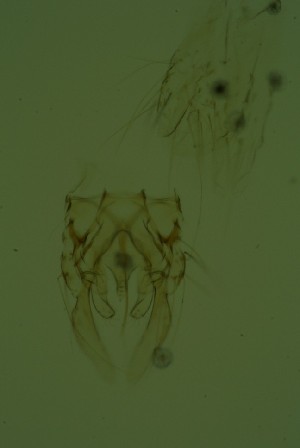  (Tanytarsus gibbosiceps - GBOL03714)  @11 [ ] Unspecified (default): All Rights Reserved  SNSB, Staatliche Naturwissenschaftliche Sammlungen Bayerns ZSM (SNSB, Zoologische Staatssammlung Muenchen)