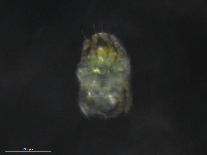  (Pterolichidae - BIOUG31591-G03)  @11 [ ] CreativeCommons - Attribution Non-Commercial Share-Alike (2019) CBG Photography Group Centre for Biodiversity Genomics