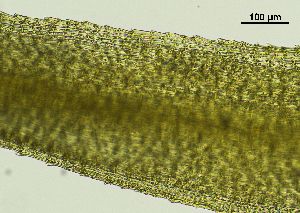  ( - REU029719)  @11 [ ] CC-BY-NC-SA (2024) Unspecified PVBMT Research Unit, University of Reunion, CIRAD