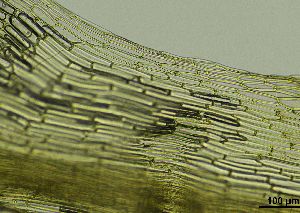  ( - REU029719)  @11 [ ] CC-BY-NC-SA (2024) Unspecified PVBMT Research Unit, University of Reunion, CIRAD