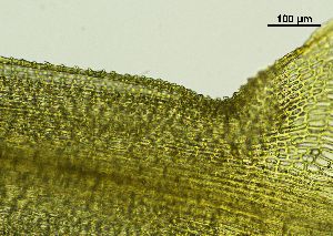  ( - REU029719)  @11 [ ] CC-BY-NC-SA (2024) Unspecified PVBMT Research Unit, University of Reunion, CIRAD