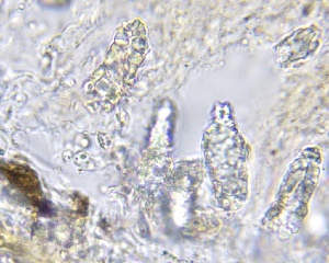  ( - HAY-F-002600)  @11 [ ] c (2023) Rudy Diaz Fungal Diversity Survey