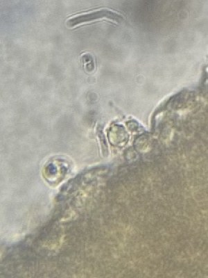  ( - HAY-F-002599)  @11 [ ] c (2023) Rudy Diaz Fungal Diversity Survey