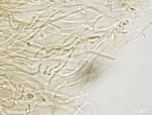  ( - FDS-CA-01646)  @11 [ ] c (2023) Rudy Diaz Fungal Diversity Survey